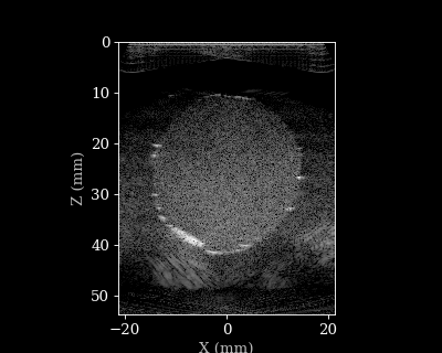 Doppler B-mode Animation